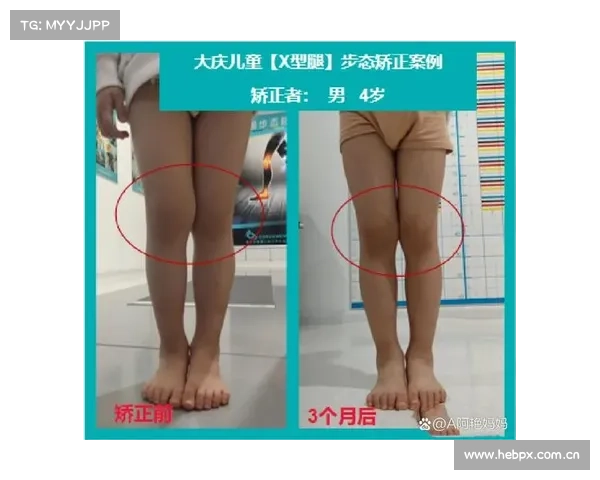 3 次重伤!克拉克膝盖 45 度外翻终结职业生涯 3 次重伤!克拉克膝盖 45 度外翻终结职业生涯