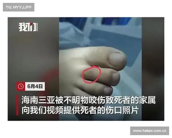 35张罕见的照片,一只蚂蚁PK毒蛇,咬的地方恰到好处毒蛇也无奈 35张罕见的照片,一只蚂蚁PK毒蛇,咬的地方恰到好处毒蛇也无奈
